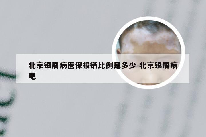 北京银屑病医保报销比例是多少 北京银屑病吧