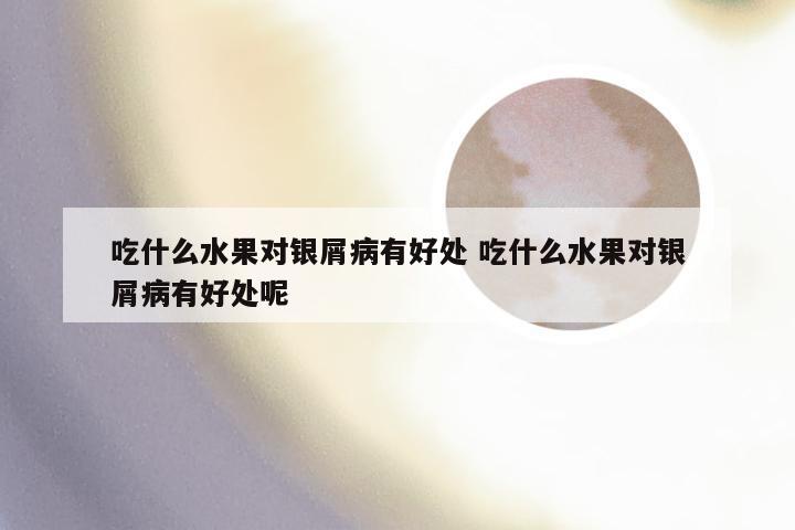 吃什么水果对银屑病有好处 吃什么水果对银屑病有好处呢