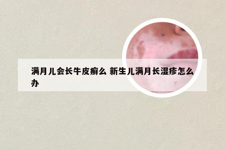 满月儿会长牛皮癣么 新生儿满月长湿疹怎么办