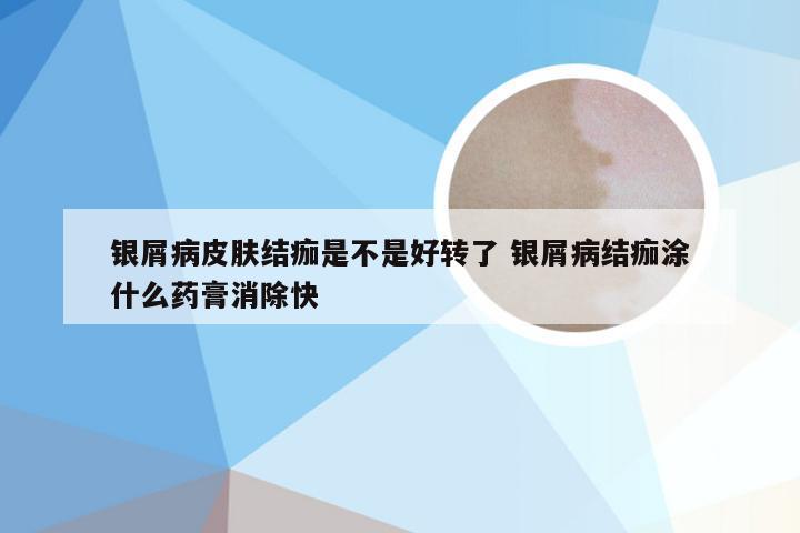 银屑病皮肤结痂是不是好转了 银屑病结痂涂什么药膏消除快
