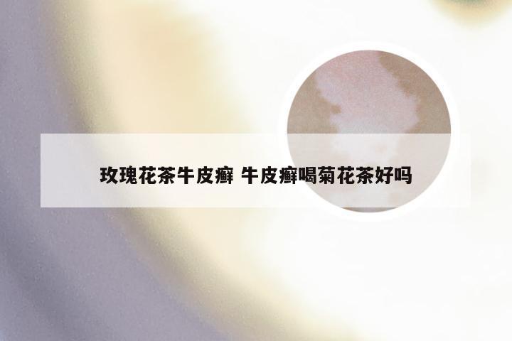 玫瑰花茶牛皮癣 牛皮癣喝菊花茶好吗