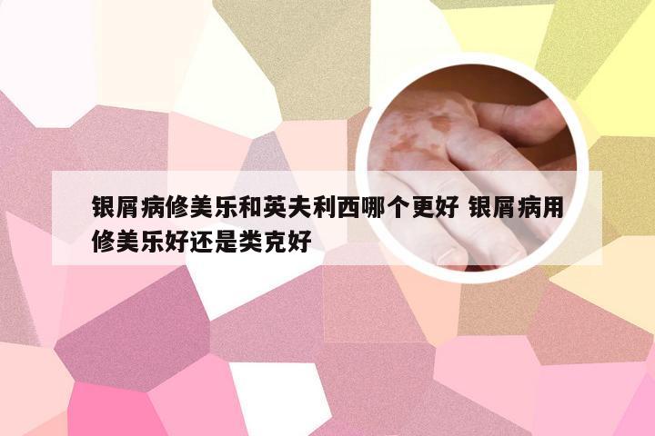 银屑病修美乐和英夫利西哪个更好 银屑病用修美乐好还是类克好