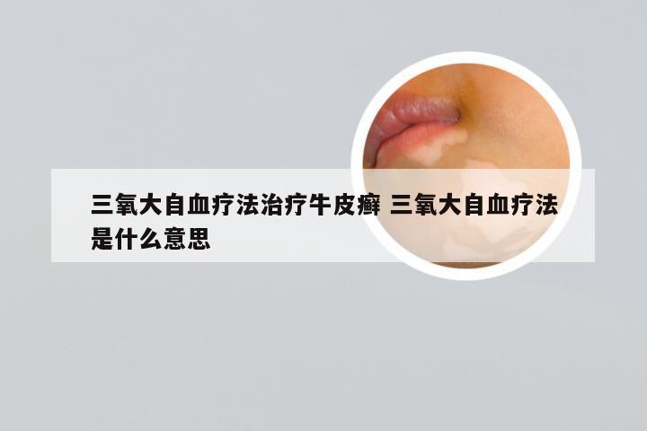三氧大自血疗法治疗牛皮癣 三氧大自血疗法是什么意思