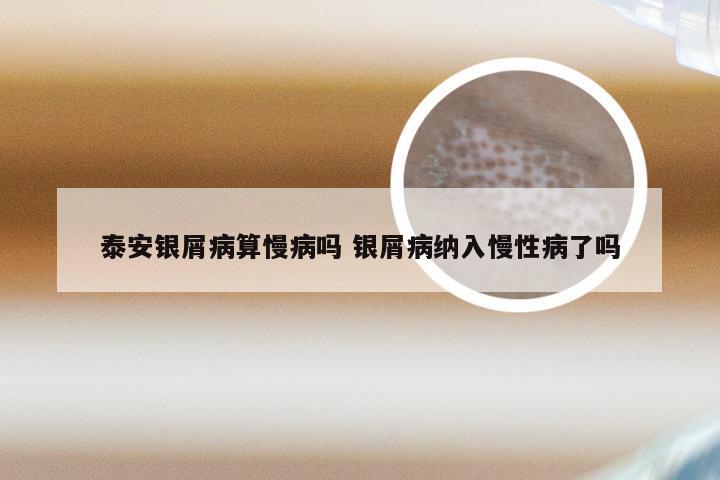 泰安银屑病算慢病吗 银屑病纳入慢性病了吗