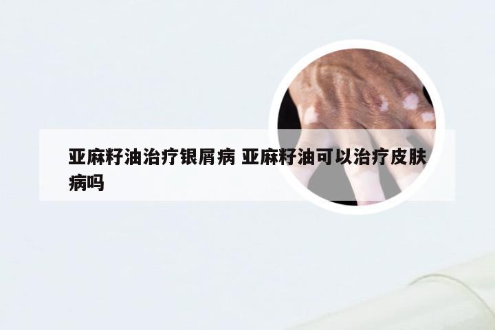 亚麻籽油治疗银屑病 亚麻籽油可以治疗皮肤病吗