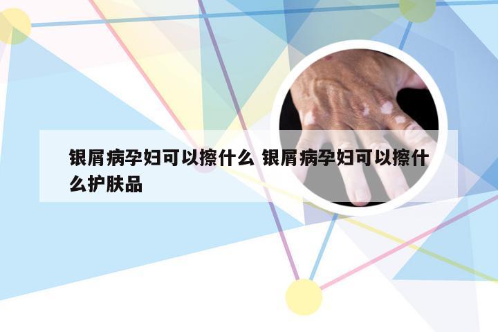 银屑病孕妇可以擦什么 银屑病孕妇可以擦什么护肤品