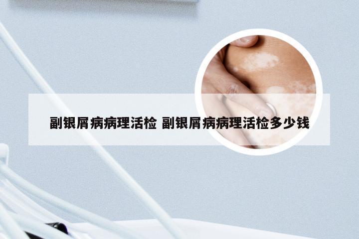 副银屑病病理活检 副银屑病病理活检多少钱
