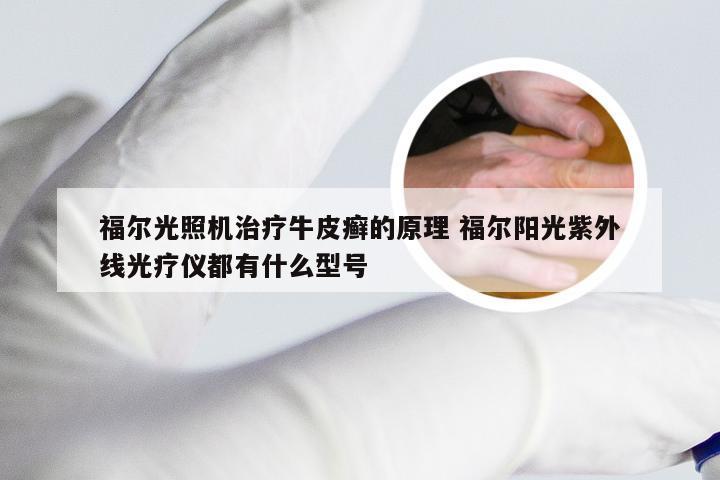 福尔光照机治疗牛皮癣的原理 福尔阳光紫外线光疗仪都有什么型号
