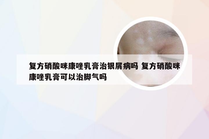 复方硝酸咪康唑乳膏治银屑病吗 复方硝酸咪康唑乳膏可以治脚气吗