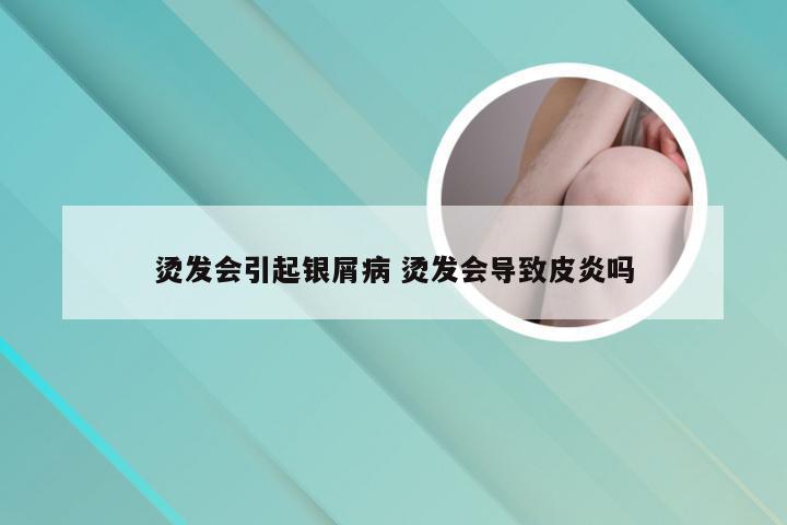烫发会引起银屑病 烫发会导致皮炎吗