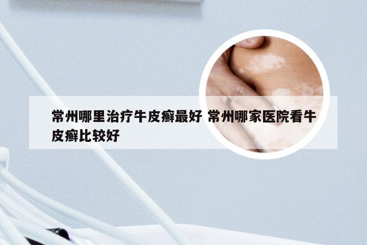 常州哪里治疗牛皮癣最好 常州哪家医院看牛皮癣比较好