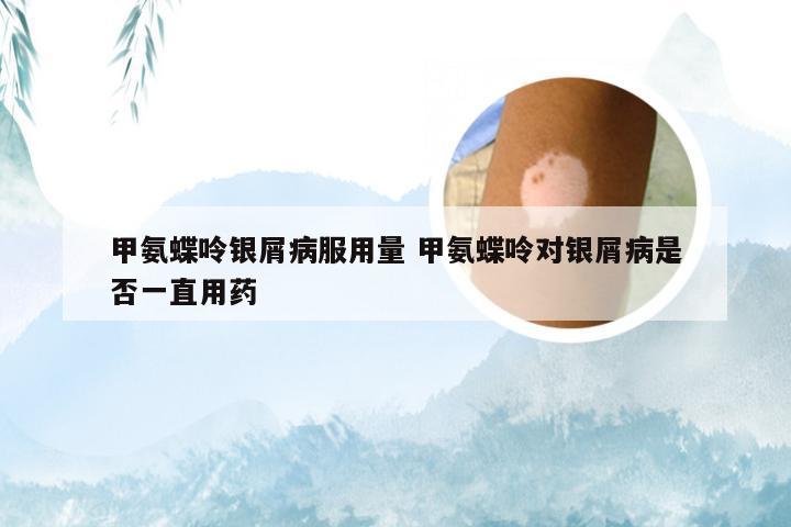甲氨蝶呤银屑病服用量 甲氨蝶呤对银屑病是否一直用药