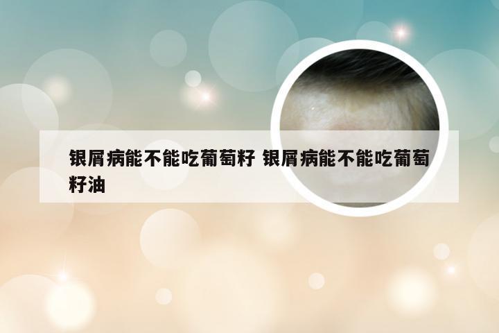 银屑病能不能吃葡萄籽 银屑病能不能吃葡萄籽油