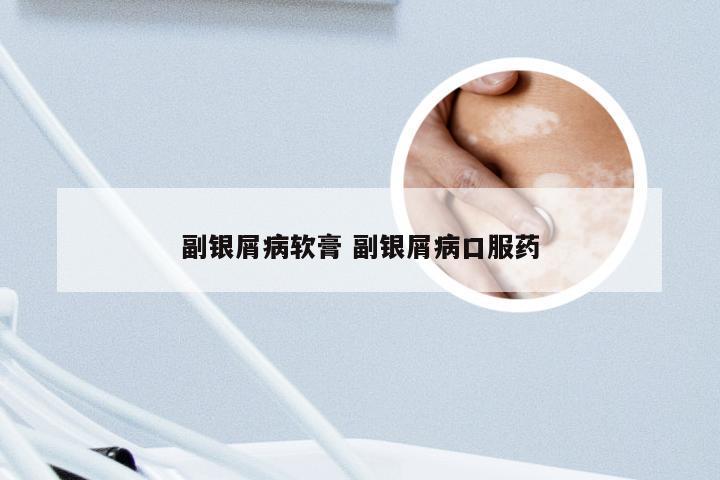 副银屑病软膏 副银屑病口服药