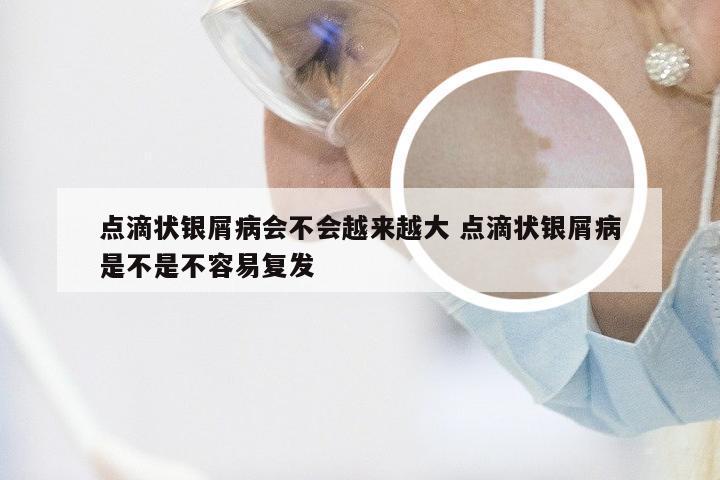 点滴状银屑病会不会越来越大 点滴状银屑病是不是不容易复发
