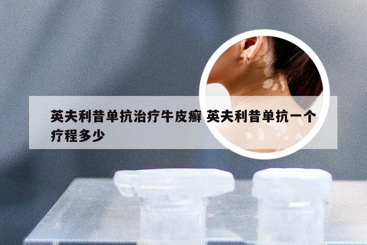 英夫利昔单抗治疗牛皮癣 英夫利昔单抗一个疗程多少