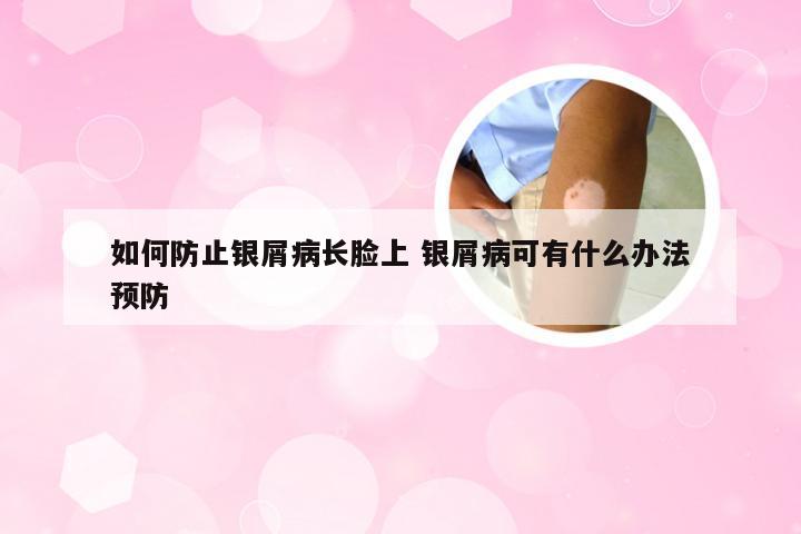 如何防止银屑病长脸上 银屑病可有什么办法预防
