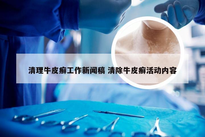 清理牛皮癣工作新闻稿 清除牛皮癣活动内容