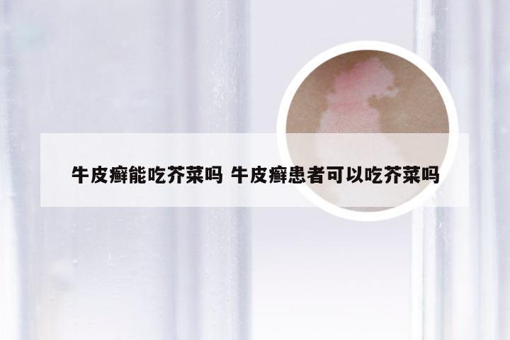 牛皮癣能吃芥菜吗 牛皮癣患者可以吃芥菜吗
