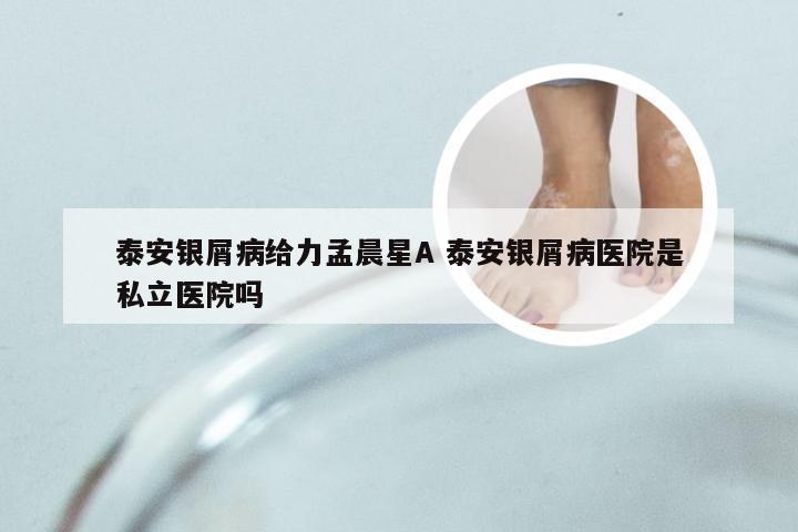 泰安银屑病给力孟晨星A 泰安银屑病医院是私立医院吗