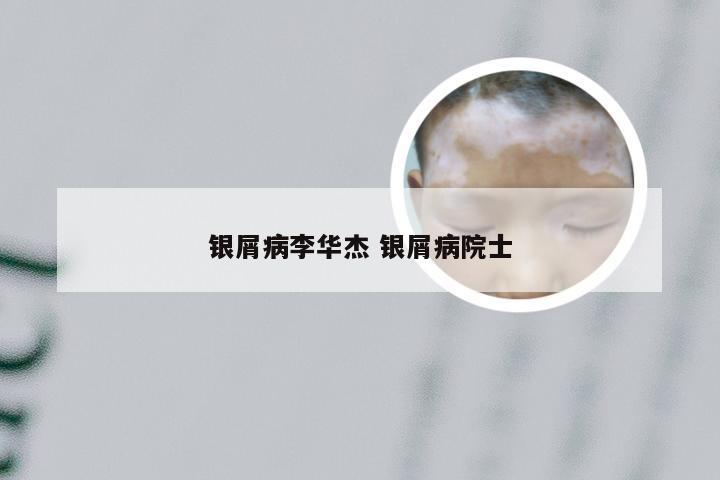银屑病李华杰 银屑病院士