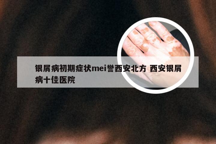银屑病初期症状mei誉西安北方 西安银屑病十佳医院