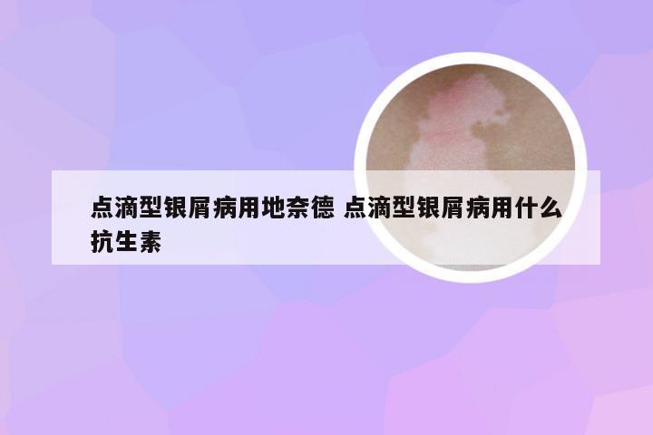 点滴型银屑病用地奈德 点滴型银屑病用什么抗生素