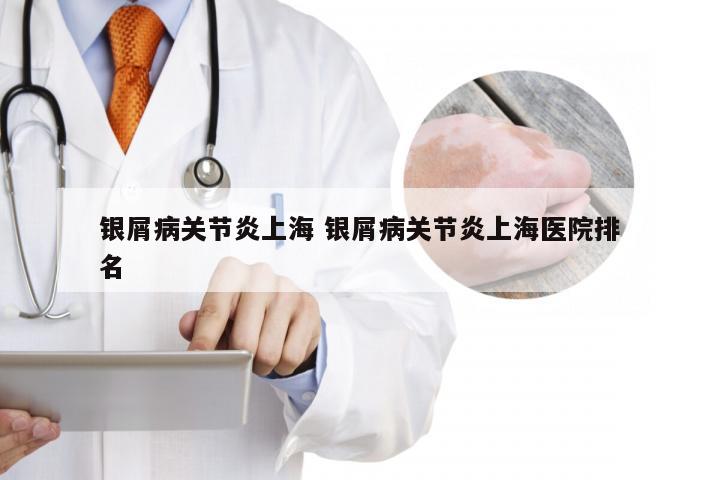 银屑病关节炎上海 银屑病关节炎上海医院排名
