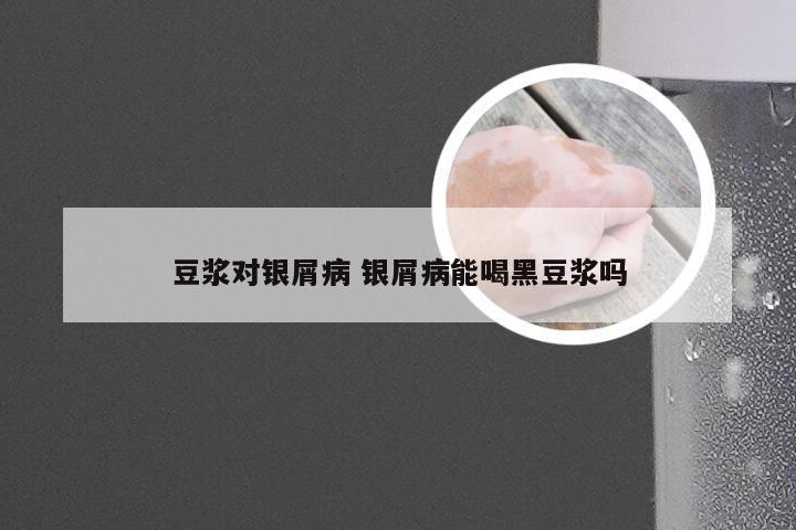 豆浆对银屑病 银屑病能喝黑豆浆吗