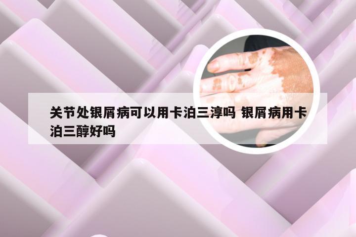 关节处银屑病可以用卡泊三淳吗 银屑病用卡泊三醇好吗