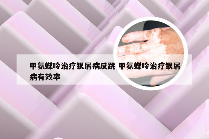 甲氨蝶呤治疗银屑病反跳 甲氨蝶呤治疗银屑病有效率