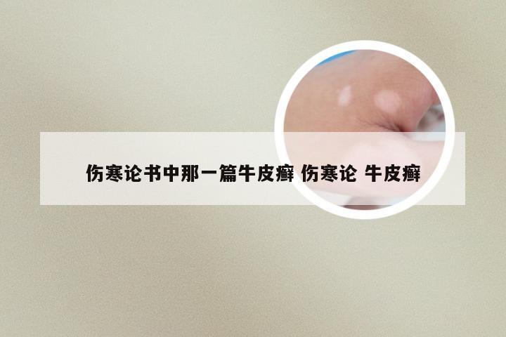 伤寒论书中那一篇牛皮癣 伤寒论 牛皮癣