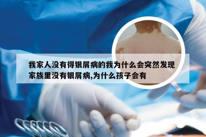 我家人没有得银屑病的我为什么会突然发现 家族里没有银屑病,为什么孩子会有