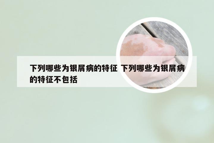 下列哪些为银屑病的特征 下列哪些为银屑病的特征不包括