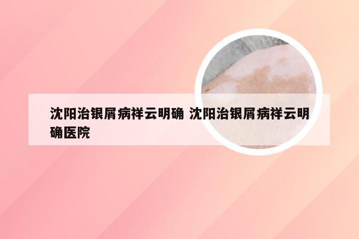 沈阳治银屑病祥云明确 沈阳治银屑病祥云明确医院