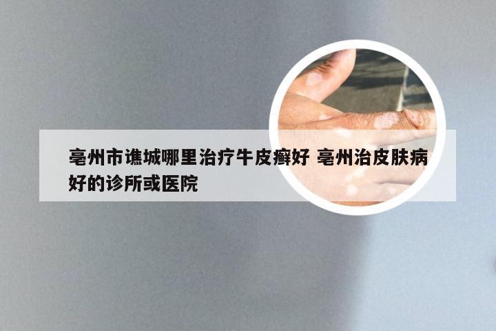 亳州市谯城哪里治疗牛皮癣好 亳州治皮肤病好的诊所或医院