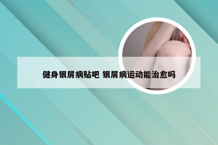 健身银屑病贴吧 银屑病运动能治愈吗