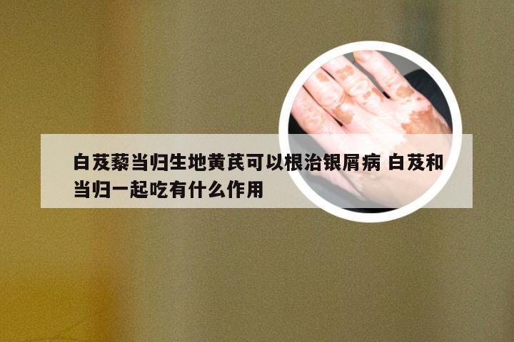 白芨藜当归生地黄芪可以根治银屑病 白芨和当归一起吃有什么作用