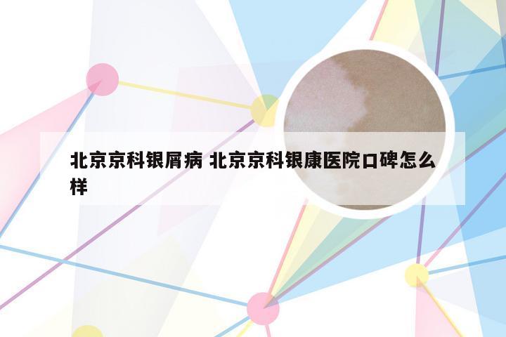 北京京科银屑病 北京京科银康医院口碑怎么样