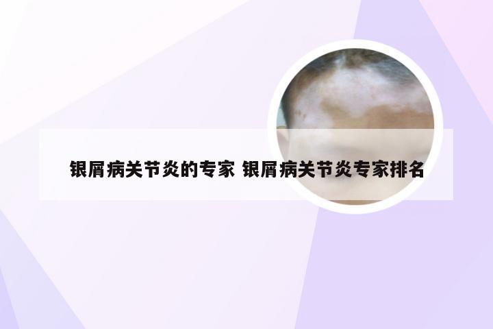 银屑病关节炎的专家 银屑病关节炎专家排名