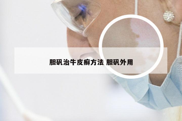 胆矾治牛皮癣方法 胆矾外用