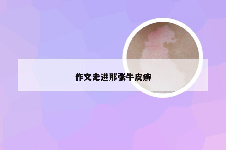 作文走进那张牛皮癣