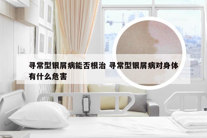 寻常型银屑病能否根治 寻常型银屑病对身体有什么危害