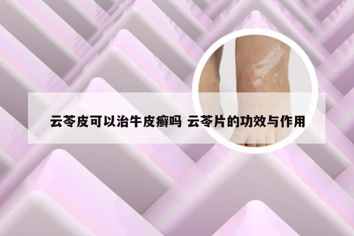 云苓皮可以治牛皮癣吗 云苓片的功效与作用