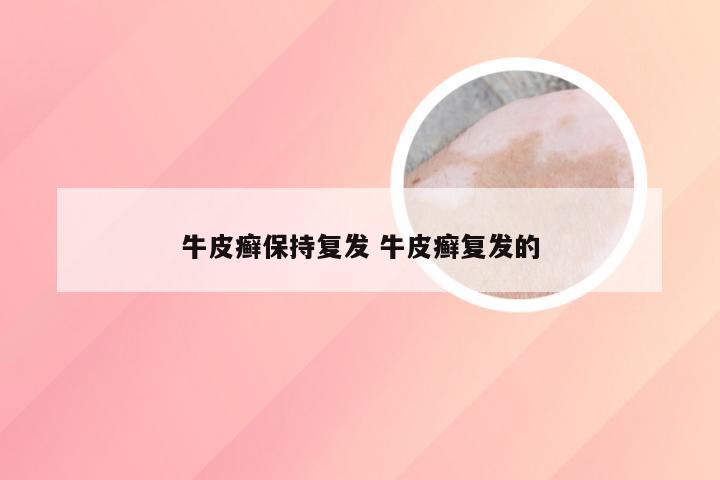 牛皮癣保持复发 牛皮癣复发的