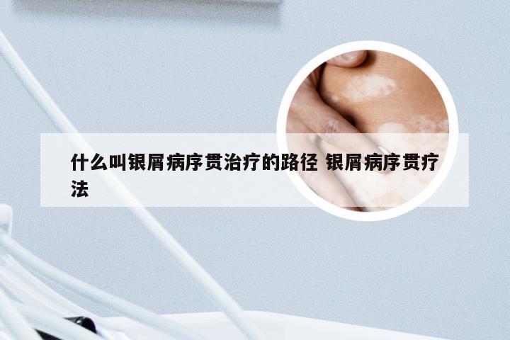 什么叫银屑病序贯治疗的路径 银屑病序贯疗法