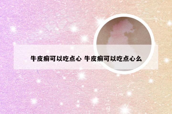 牛皮癣可以吃点心 牛皮癣可以吃点心么