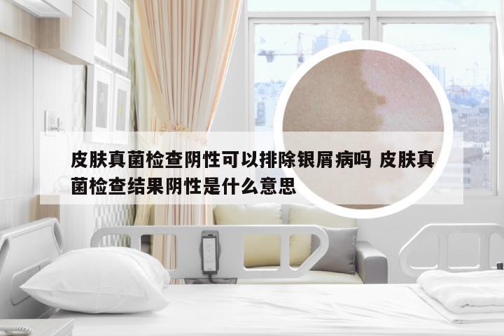 皮肤真菌检查阴性可以排除银屑病吗 皮肤真菌检查结果阴性是什么意思