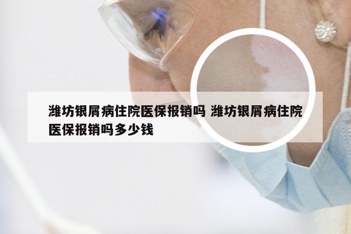 潍坊银屑病住院医保报销吗 潍坊银屑病住院医保报销吗多少钱