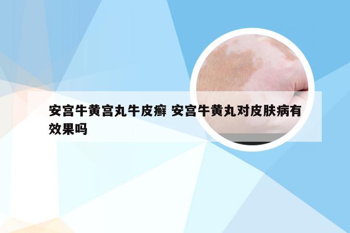 安宫牛黄宫丸牛皮癣 安宫牛黄丸对皮肤病有效果吗